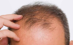 Tumbuhkan Rambut dengan Resep Alami