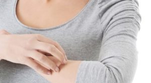Cara Mencegah Infeksi Jamur pada Kulit dan Tubuh